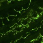 Where is the Cell Membrane Located on a Cell